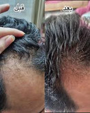 تونیک اورجینال اصل کاهش ریزش مو و محرک سرعت رشد مو تقویت کننده مو ۳۰۰ میل ارسال مستقیم از شرکت ایرانیان زمین