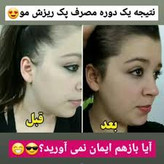 خرید عمده 10عددی تونیک رشد مو اصل تضمینی ۳۰۰ میل ارسال مستقیم از شرکت ایرانیان زمین