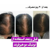 خرید عمده 10عددی تونیک رشد مو اصل تضمینی ۳۰۰ میل ارسال مستقیم از شرکت ایرانیان زمین