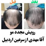 خرید عمده 10عددی تونیک کاهش ریزش مو و رشد مجدد مو اصل تضمینی ۳۰۰ میل ارسال مستقیم از شرکت ایرانیان زمین