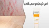 کرم رفع ترک های پوستی ران سینه باسن و بازو گاتیو ایتالیا 100 میل