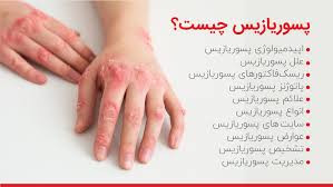 کرم کمک به رفع پسوریازیس ویتامین E و آلوئه ورا ویتابلا اصل ضمانتی مستقیم از شرکت ایرانیان زمین
