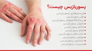 کرم درمانی کمک به رفع پسوریازیس ویتامین E و آلوئه ورا ویتابلا اصل ضمانتی مستقیم از شرکت ایرانیان زمین