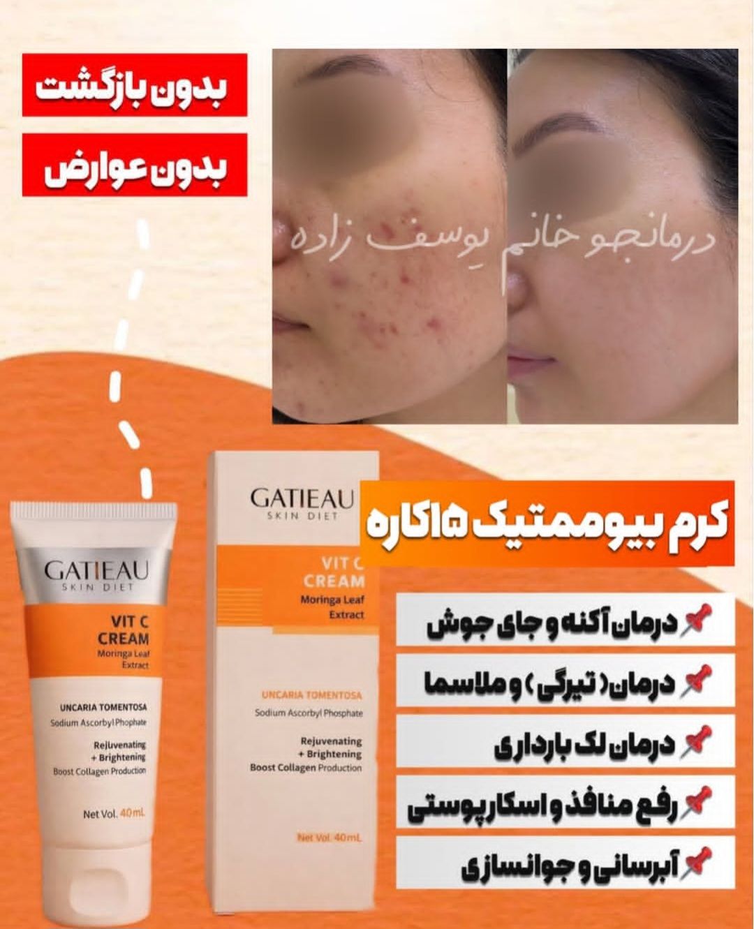 کرم بیوممتیک ضد لک جهانی جوانساز کلاژن ساز ضد جوش گاتیو 12کاره ویتامین سی