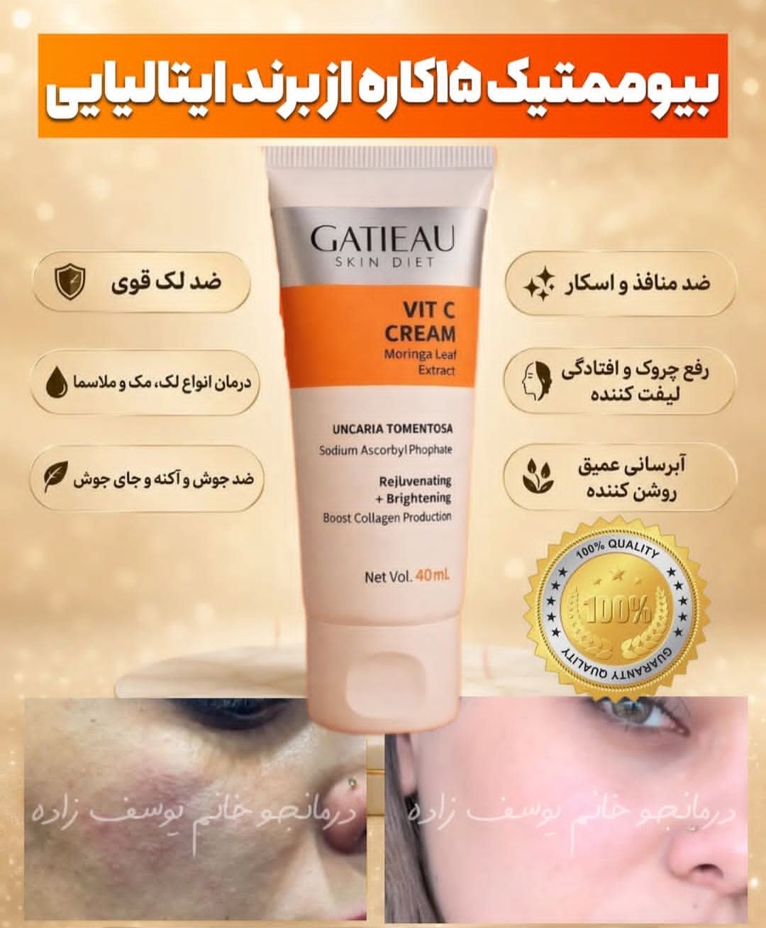 کرم بیوممتیک ضد لک جهانی و روشن کننده کهنده منافذ  ویتامین سی گاتیو