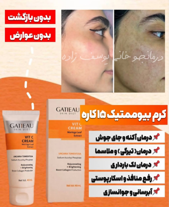 کرم ۱۵کاره اورجینال جوانساز و ترمیم کننده پوست ومحرک قوی پوست برای سنتز کلاژن و ضد لک و اکنه و شفاف کننده گاتیو ایتالیا- ویتامین سی ۴۰ میل