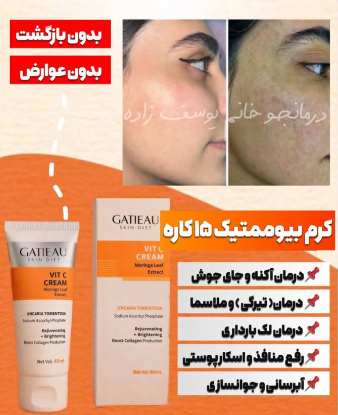 کرم بیوممتیک ضد لک جهانی و روشن کننده کاهنده منافذ ویتامین سی گاتیو