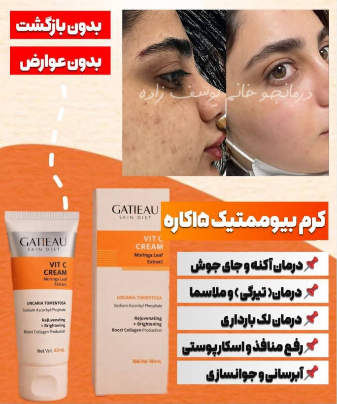 کرم بیوممتیک ضد لک جهانی و روشن کننده کاهنده منافذ ویتامین سی گاتیو